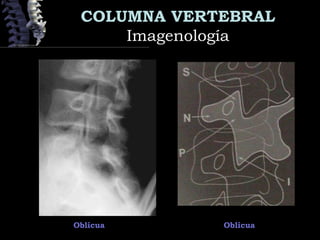 COLUMNA VERTEBRAL
ImagenologíaImagenología
Oblícua Oblícua
 