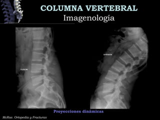 COLUMNA VERTEBRAL
ImagenologíaImagenología
Proyecciones dinámicas
McRae. Ortopedia y Fracturas
 