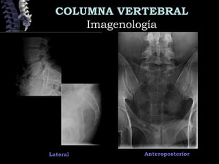 COLUMNA VERTEBRAL
ImagenologíaImagenología
Lateral Anteroposterior
 