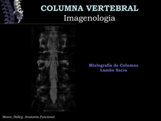 COLUMNA VERTEBRAL
ImagenologíaImagenología
Mielografía de Columna
Lumbo Sacra
Moore; Dalley. Anatomía Funcional
 