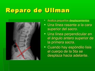 Linea Rasante Columna dor lumb | PPT