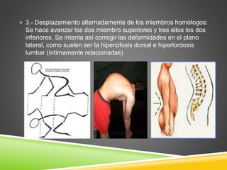  3.- Desplazamiento alternadamente de los miembros homólogos:
Se hace avanzar los dos miembro superiores y tras ellos los dos
inferiores. Se intenta así corregir las deformidades en el plano
lateral, como suelen ser la hipercifosis dorsal e hiperlordosis
lumbar (íntimamente relacionadas)
 