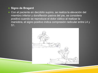  Signo de Bragard
 Con el paciente en decúbito supino, se realiza la elevación del
miembro inferior y dorsiflexión pasiva del pie, se considera
positivo cuando se reproduce el dolor ciático al realizar la
maniobra, el signo positivo indica compresión radicular entre L4 y
S1.
 