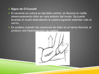  Signo de O’Connell
 El paciente se coloca en decúbito ventral, se flexiona la rodilla
desencadenando dolor en cara anterior del muslo. Se puede
levantar el muslo extendiendo la cadera logrando extender más el
nervio.
 Es positivo cuando hay presencia de dolor en el nervio femoral, al
producir una hiperextensión de cadera.
 