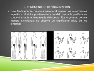  FENÓMENO DE CENTRALIZACIÓN.
 Este fenómeno se presenta cuando al realizar los movimientos
repetitivos el dolor previamente extendido hacia la periferia se
concentra hacia la línea media del cuerpo. Por lo general, de una
manera simultánea, se observa un significante alivio de los
síntomas
 