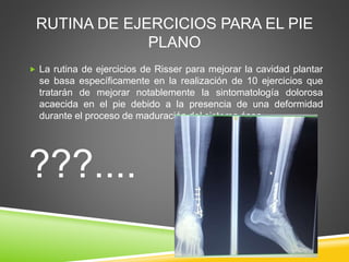 RUTINA DE EJERCICIOS PARA EL PIE
PLANO
 La rutina de ejercicios de Risser para mejorar la cavidad plantar
se basa específicamente en la realización de 10 ejercicios que
tratarán de mejorar notablemente la sintomatología dolorosa
acaecida en el pie debido a la presencia de una deformidad
durante el proceso de maduración del sistema óseo.
???....
 