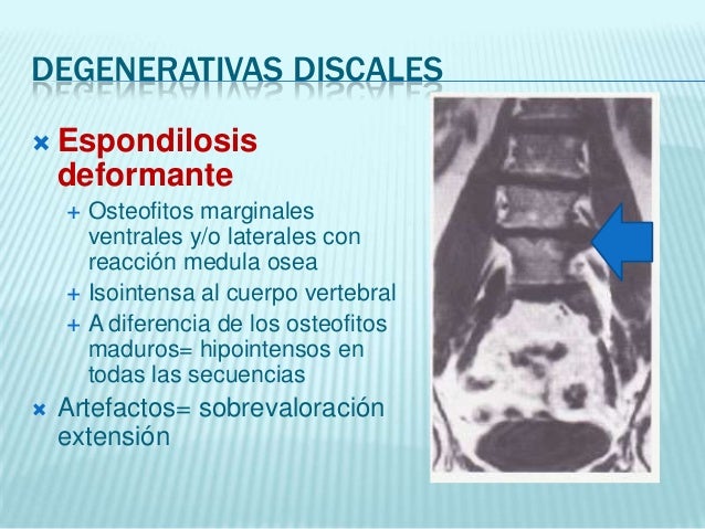 El dolor en el huevo da fuerte en los riñones