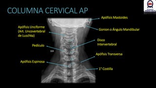 columna vertebral | PDF