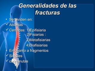 Generalidades de las
            fracturas
• Se dividen en:
 Abiertas
 Cerradas: 1)Epifisiaria
            2)Fisiarias :
            3)Metafisiarias
            4)Diafisiarias
• En cuanto a fragmentos
 Simples
 conminutas
 
