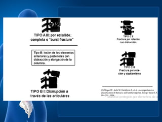 Columna terminamos