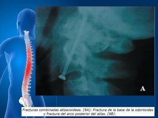 Columna terminamos