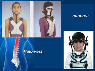 minerva




Halo vest
 