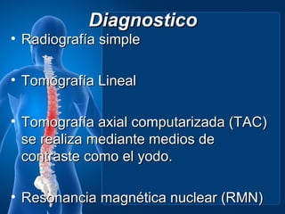 Diagnostico
• Radiografía simple

• Tomografía Lineal

• Tomografía axial computarizada (TAC)
  se realiza mediante medios de
  contraste como el yodo.

• Resonancia magnética nuclear (RMN)
 