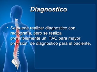 Diagnostico

• Se puede realizar diagnostico con
  radiografía, pero se realiza
  preferiblemente un TAC para mayor
  precisión de diagnostico para el paciente.
 