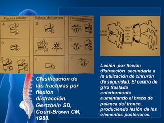 Lesión por flexión
                    distracción secundaria a
                    la utilización de cinturón
Clasificación de    de seguridad. El centro de
las fracturas por   giro traslada
flexión             anteriormente
distracción.        aumentando el brazo de
Gertzbein SD,       palanca del tronco,
                    produciendo lesión de los
Court-Brown CM,     elementos posteriores.
1988.
 