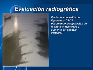 Evaluación radiográfica
             Paciente con lesión de
             ligamentos C5-C6
             observando la separación de
             la apófisis espinosas y
             aumento del espacio
             vertebral
 