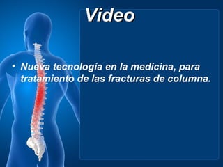 Video

• Nueva tecnología en la medicina, para
  tratamiento de las fracturas de columna.
 
