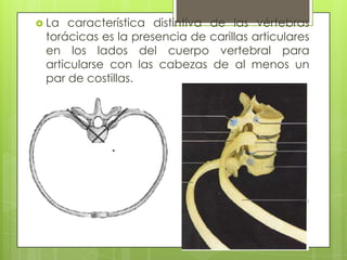  La

característica distintiva de las vértebras
torácicas es la presencia de carillas articulares
en los lados del cuerpo vertebral para
articularse con las cabezas de al menos un
par de costillas.

 