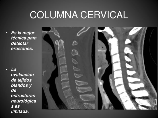 El dolor en sheynom el departamento de la columna vertebral y la náusea
