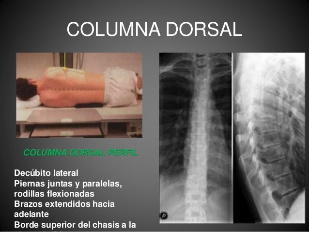 Columna vertebral