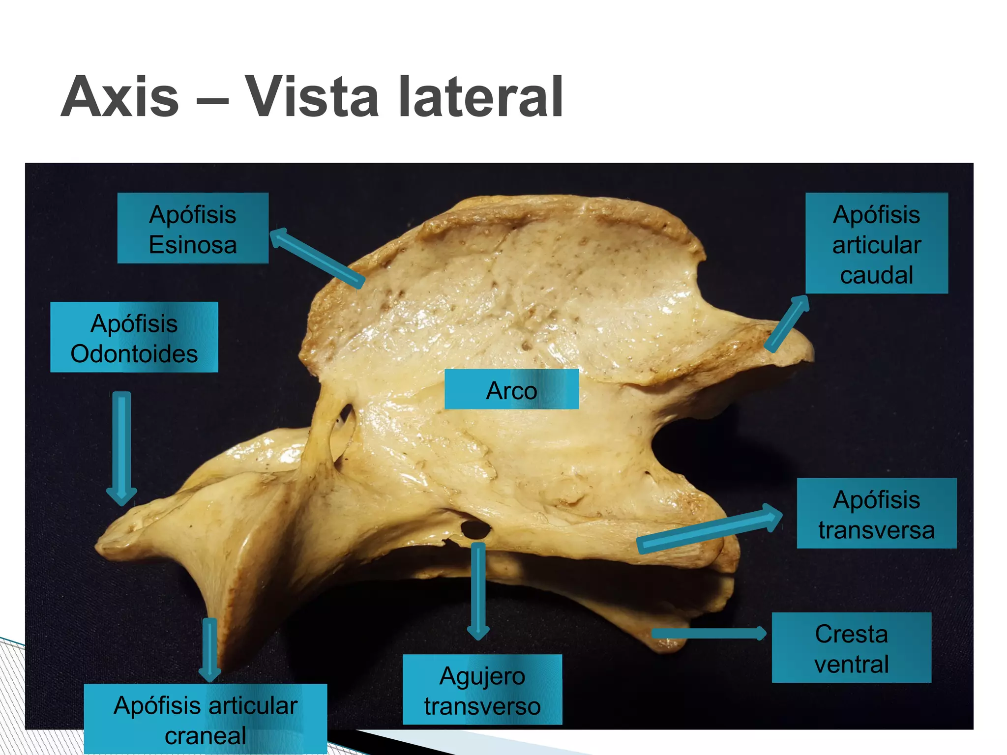Axis – Vista lateral
Apófisis
Odontoides
Agujero
transverso
Cresta
ventral
Apófisis
transversa
Apófisis
Esinosa
Apófisis
articular
caudal
Apófisis articular
craneal
Arco
 