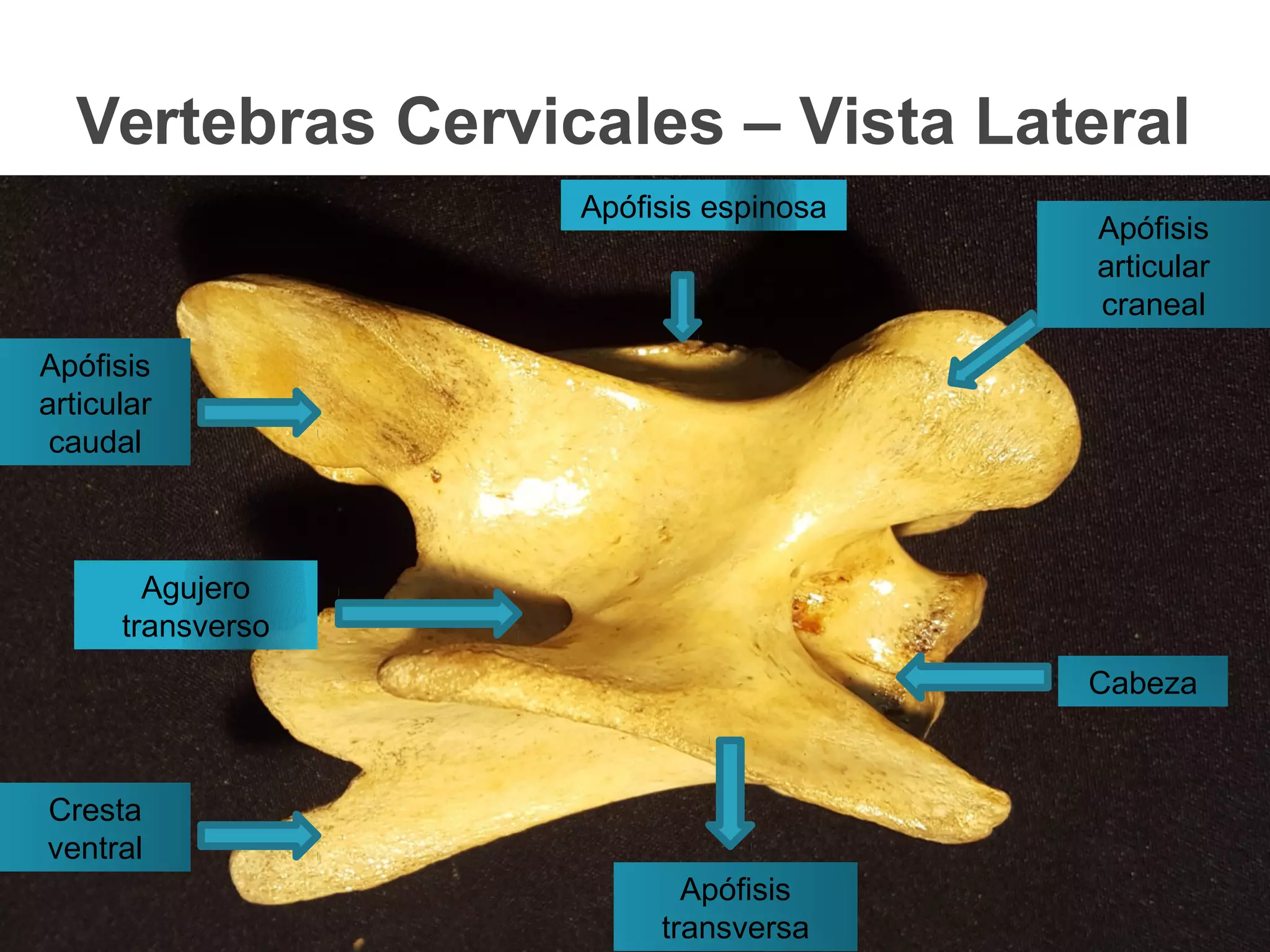 Vertebras Cervicales – Vista Lateral
Cabeza
Apófisis
transversa
Cresta
ventral
Apófisis
articular
caudal
Apófisis
articular
craneal
Apófisis espinosa
Agujero
transverso
 