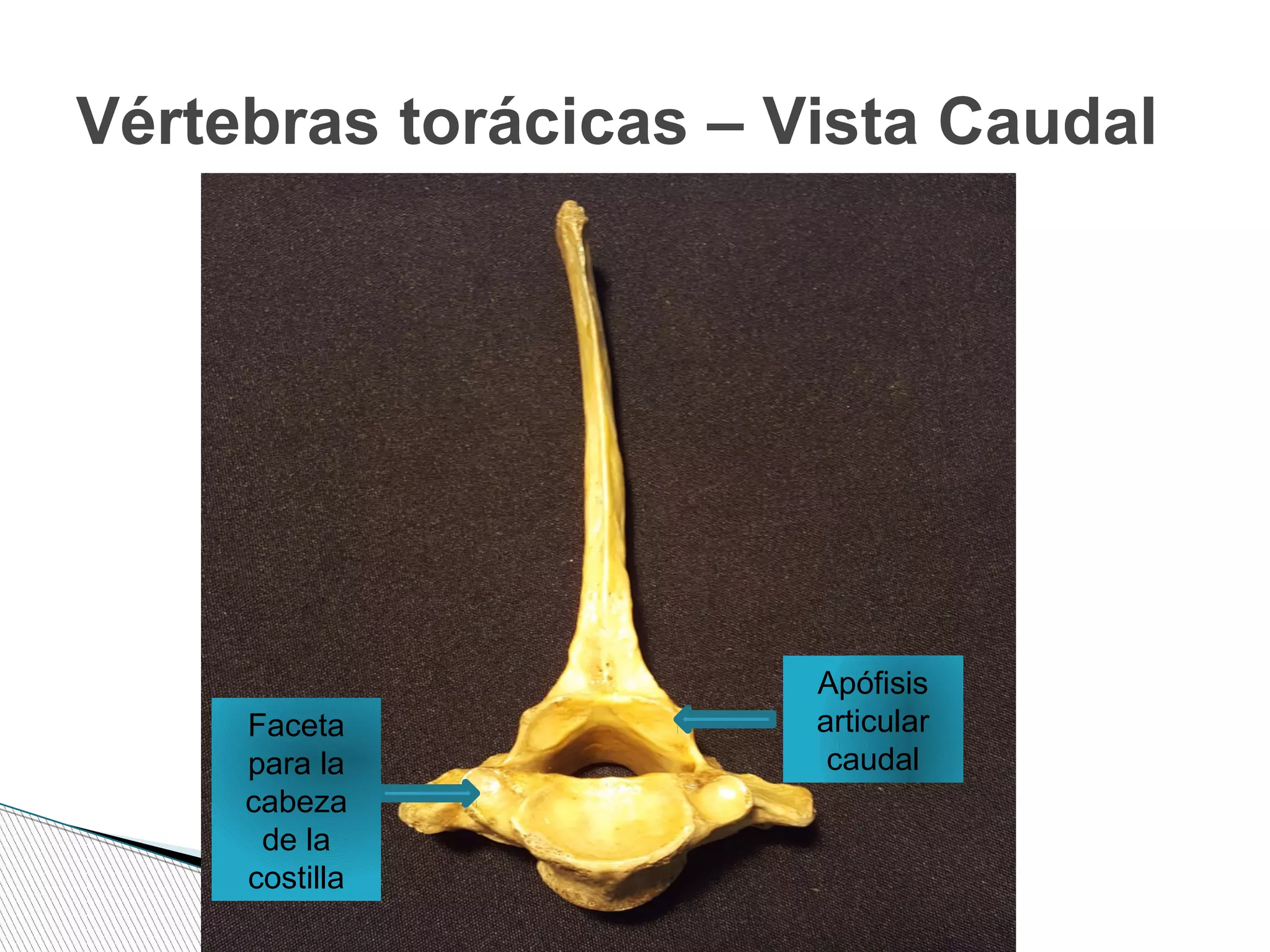 Vértebras torácicas – Vista Caudal
Apófisis
articular
caudal
Faceta
para la
cabeza
de la
costilla
 