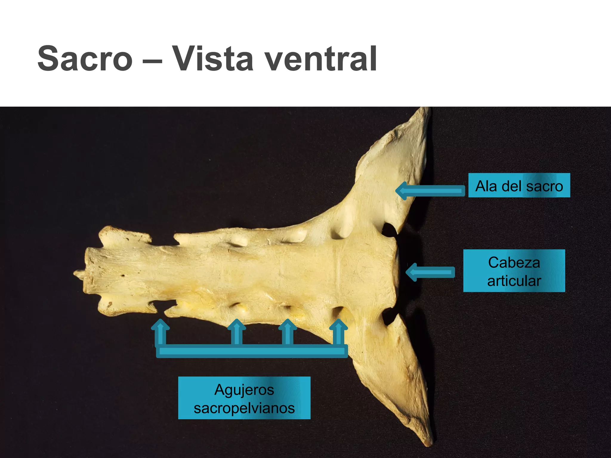Sacro – Vista ventral
Agujeros
sacropelvianos
Cabeza
articular
Ala del sacro
 