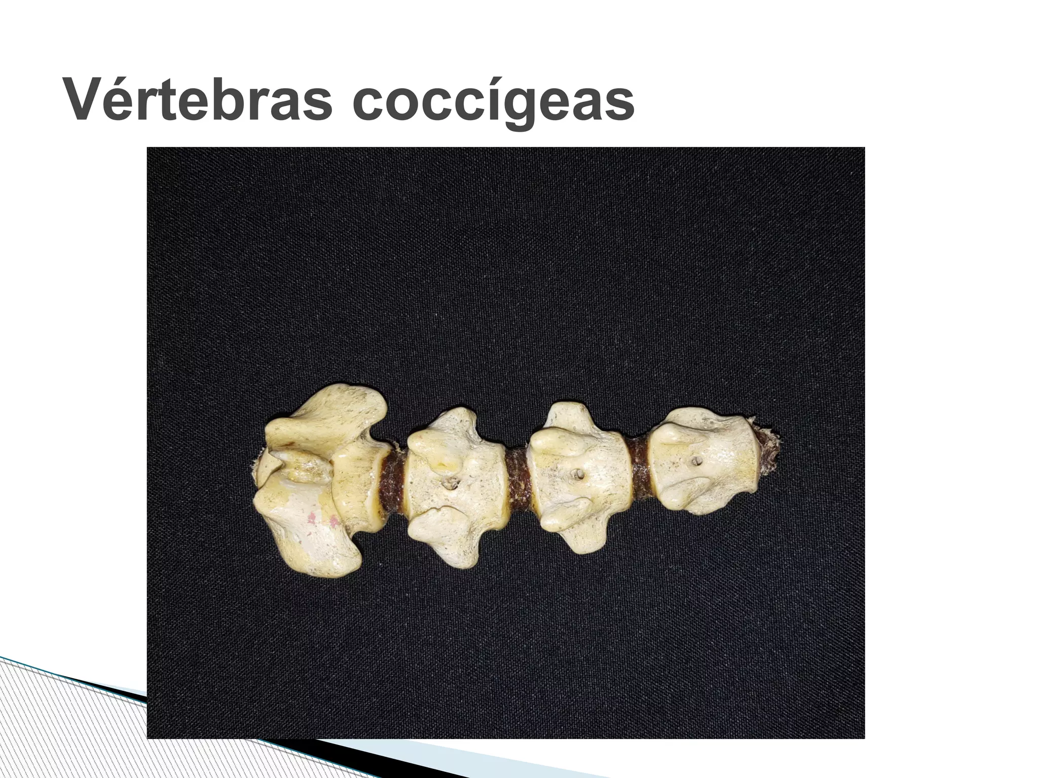 Vértebras coccígeas
 