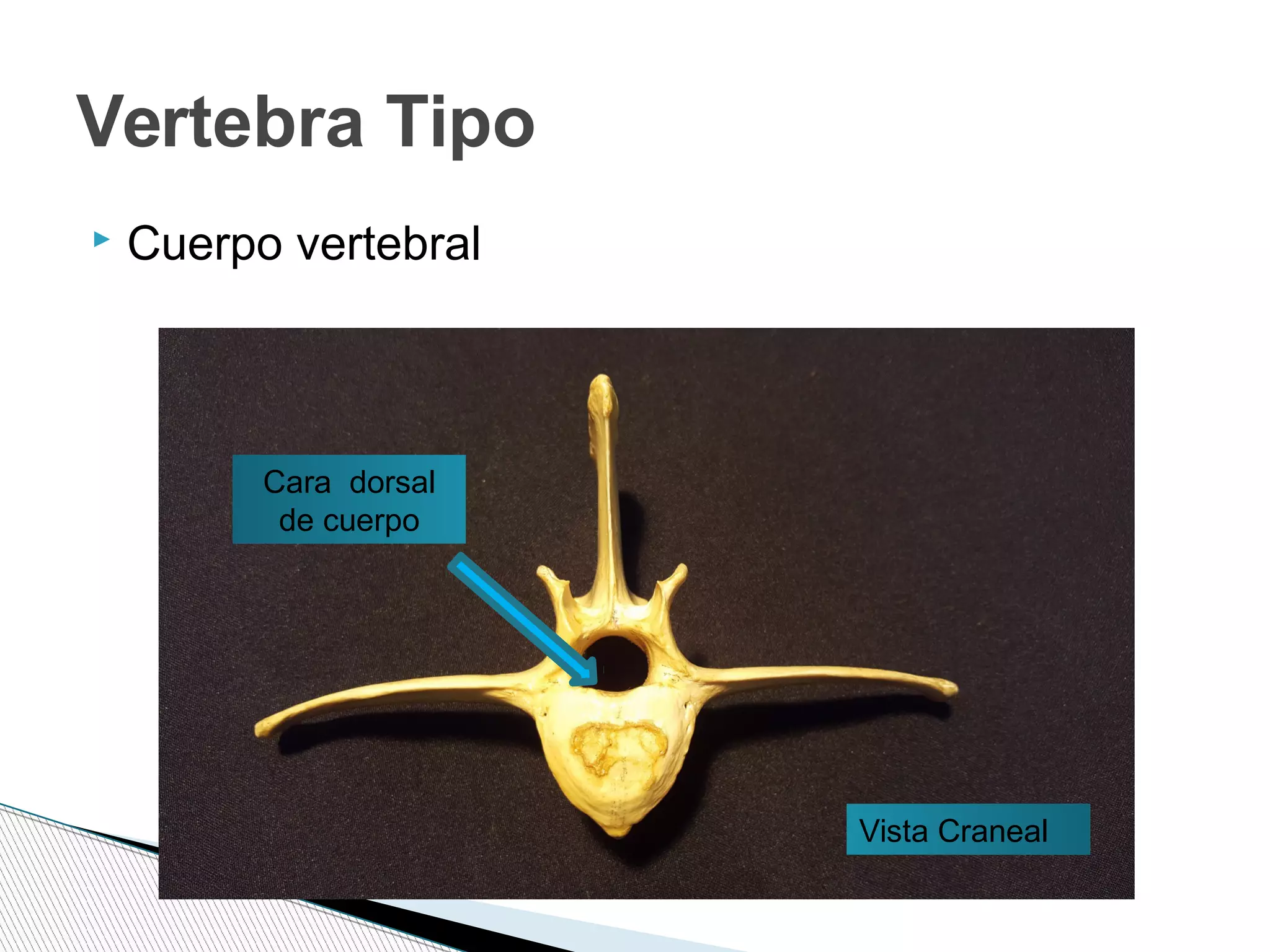  Cuerpo vertebral
Vertebra Tipo
Cara dorsal
de cuerpo
Vista Craneal
 