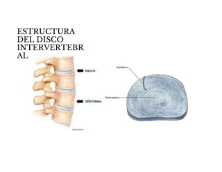 ESTRUCTURA
DEL DISCO
INTERVERTEBR
AL
 