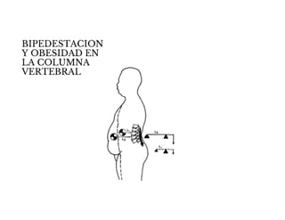 BIPEDESTACION
Y OBESIDAD EN
LA COLUMNA
VERTEBRAL
 