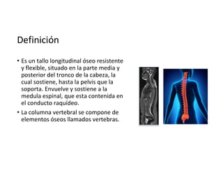 Definición
• Es un tallo longitudinal óseo resistente
y flexible, situado en la parte media y
posterior del tronco de la cabeza, la
cual sostiene, hasta la pelvis que la
soporta. Envuelve y sostiene a la
medula espinal, que esta contenida en
el conducto raquídeo.
• La columna vertebral se compone de
elementos óseos llamados vertebras.
 