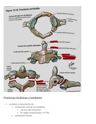 RESUMEN DE COLUMNA VERTEBRAL. NETTER ORTOPEDIA.pdf