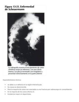 RESUMEN DE COLUMNA VERTEBRAL. NETTER ORTOPEDIA.pdf