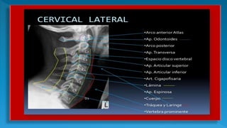 Columna Vertebral RX | PPTX