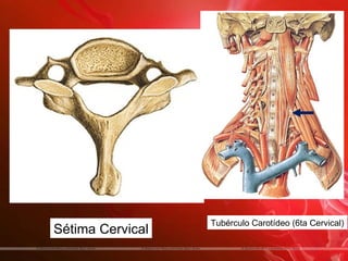 Tubérculo Carotídeo (6ta Cervical)
Sétima Cervical
 
