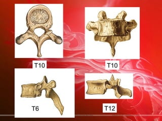 T10   T10




T6    T12
 