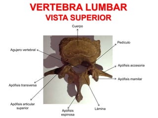 VERTEBRA LUMBAR
VISTA SUPERIOR
Cuerpo
Agujero vertebral
Apófisis accesoria
Apófisis mamilar
Pedículo
Apófisis transversa
Apófisis articular
superior Lámina
Apófisis
espinosa
 