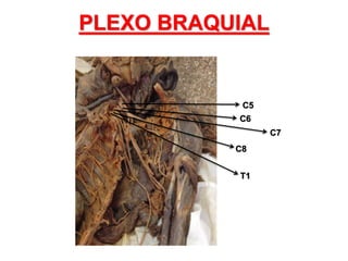 PLEXO BRAQUIAL
C5
C6
C7
C8
T1
 