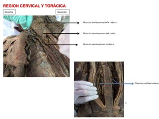 REGION CERVICAL Y TORÁCICA
Derecha Izquierda
Musculo semiespioso de la cabeza
Músculo semiespinoso del cuello
Musculo semiespinoso torácico
 