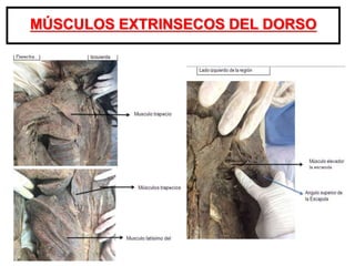 MÚSCULOS EXTRINSECOS DEL DORSO
 