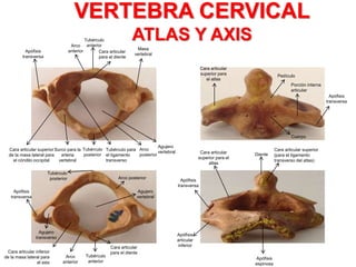 VERTEBRA CERVICAL
ATLAS Y AXIS
Cara articular superior
de la masa lateral para
el cóndilo occipital
Surco para la
arteria
vertebral
Tubérculo para
el ligamento
transverso
Tubérculo
posterior
Arco
posterior
Agujero
vertebral
Masa
vertebral
Cara articular
para el diente
Tubérculo
anteriorArco
anteriorApófisis
transversa
Pedículo
Porción interna
articular
Apófisis
transversa
Cuerpo
Cara articular
superior para
el atlas
Diente
Cara articular superior
(para el ligamento
transverso del atlas)
Apófisis
transversa
Cara articular
superior para el
atlas
Apófisis
articular
inferior
Apófisis
espinosa
Cara articular
para el diente
Tubérculo
anterior
Arco
anterior
Tubérculo
posterior Arco posterior
Agujero
vertebral
Agujero
transverso
Cara articular inferior
de la masa lateral para
el axis
Apófisis
transversa
 