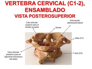 VERTEBRA CERVICAL (C1-2),
ENSAMBLADO
VISTA POSTEROSUPERIOR
Cara articular
superior para el
cóndilo occipital
Cara articular
posterior (para el
ligamento transverso
del atlas)
Diente
Atlas (C1)
Axis (C2)
Articulación
atlantoaxial lateral
 