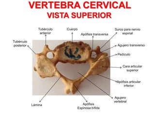VERTEBRA CERVICAL
VISTA SUPERIOR
CuerpoTubérculo
anterior
Tubérculo
posterior
Lámina Apófisis
Espinosa bífida
Agujero
vertebral
Apófisis articular
inferior
Cara articular
superior
Pedículo
Agujero transverso
Surco para nervio
espinalApófisis transversa
 