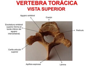 VERTEBRA TORÁCICA
VISTA SUPERIOR
Cuerpo
Agujero vertebral
Escotadura vertebral
superior (forma el
borde inferior del
agujero
intervertebral)
Carilla articular
superior
LáminaApófisis espinosa
Pedículo
 