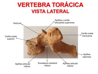 VERTEBRA TORÁCICA
VISTA LATERAL
Carilla costal
superior
Carilla costal
transversa
Pedículo
Apófisis y carilla
articulares superiores
Apófisis articular
inferior
Escotadura vertebral
inferior
Apófisis articular
inferior
Apófisis
espinosa
 