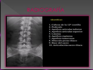 Vertebral Pathologies Comprehensive Overview of Vertebral Anatomy, Pathologies, and Imaging ...