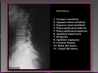 Vertebral Pathologies Comprehensive Overview of Vertebral Anatomy, Pathologies, and Imaging ...