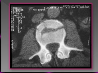 Vertebral Pathologies Comprehensive Overview of Vertebral Anatomy, Pathologies, and Imaging ...